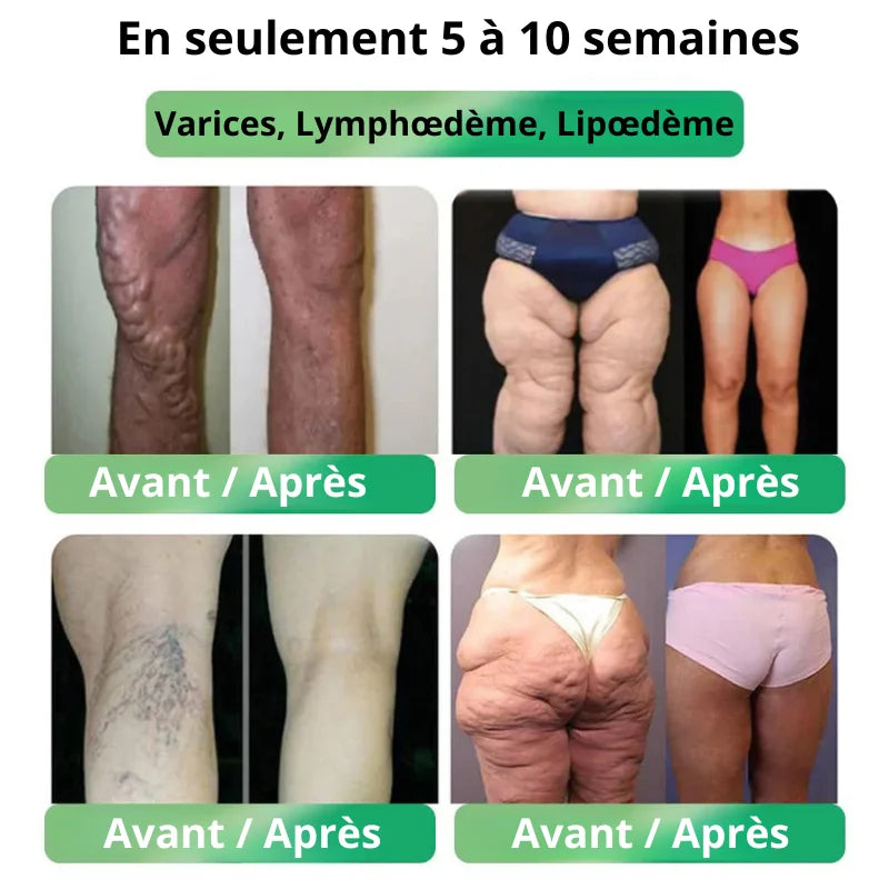 Ampoules Minceur GLP-1 Naturelles